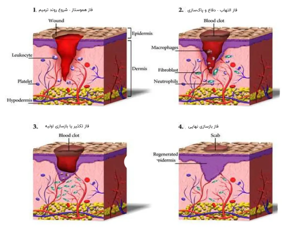 روند و مراحل فاز های بهبود زخم 